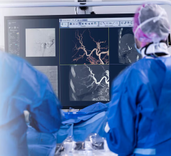New Technology that Enhances CBCT Image Quality Now Available