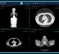 Visage Imaging, Inc., a wholly owned subsidiary of Pro Medicus Ltd., has announced it will showcase new product enhancements and innovations for the industry-leading Visage 7 Enterprise Imaging Platform